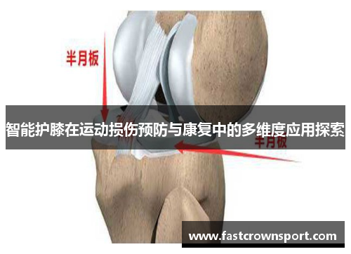 智能护膝在运动损伤预防与康复中的多维度应用探索